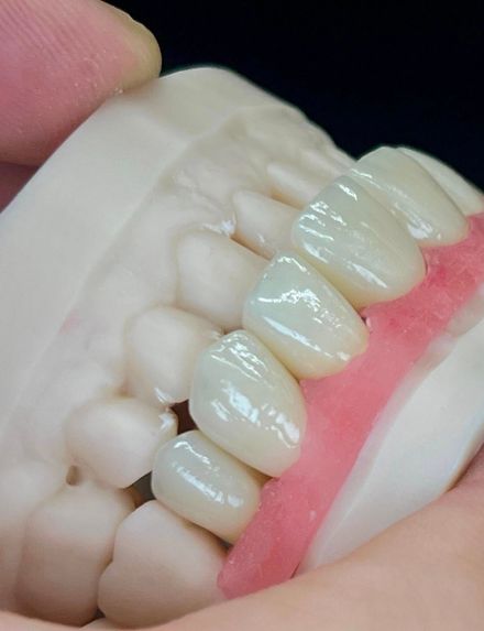 Primo piano di un modello dentale che mostra denti bianchi, gengive rosa e una mano che lo tiene.