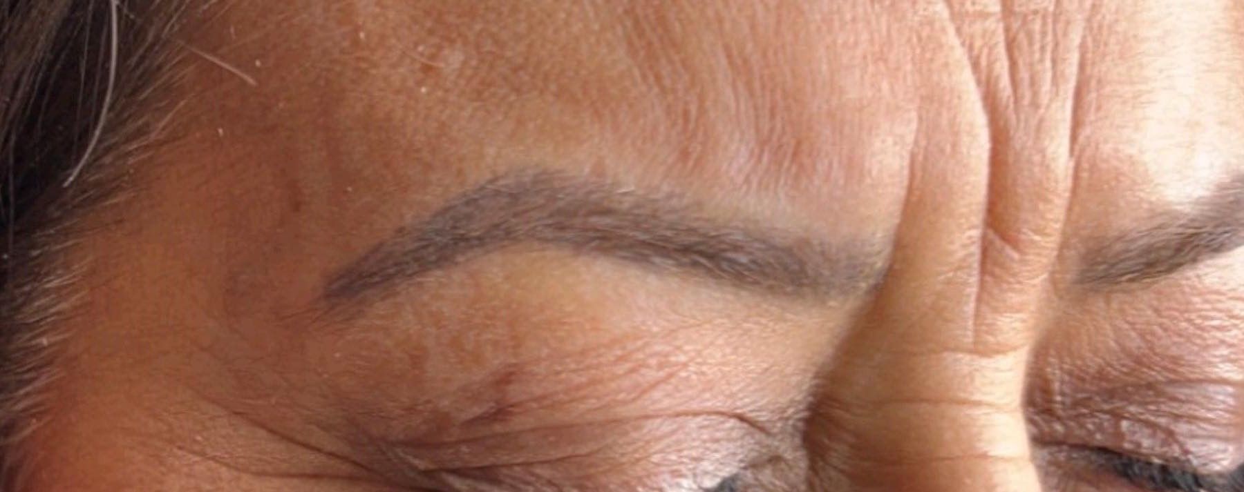 A close up of a woman 's forehead with a hand on it.