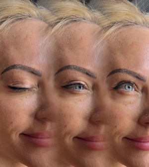 A woman is getting a permanent makeup tattoo on her eyebrows.