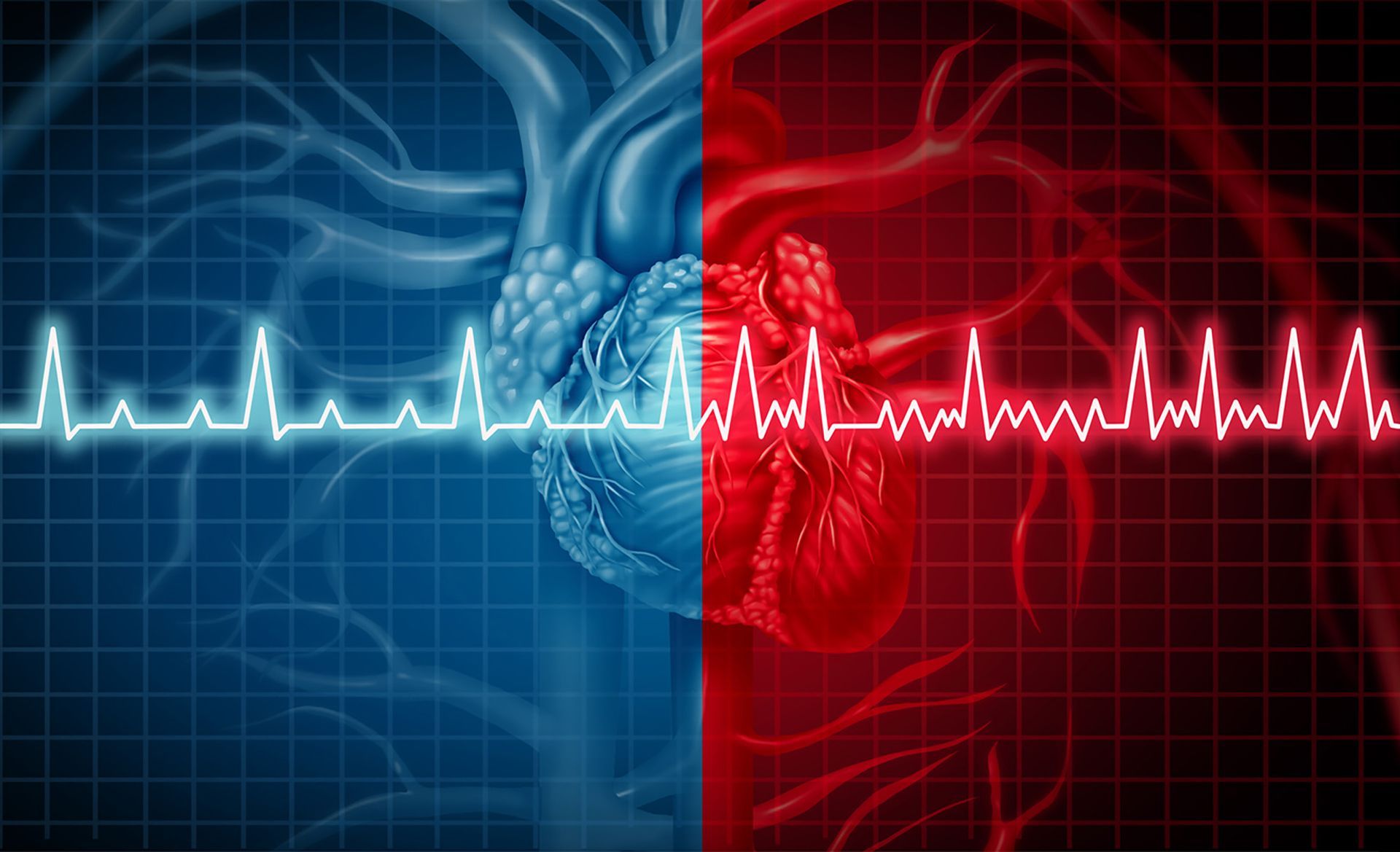 6 Pontos Importantes Sobre Arritmias Cardíacas Que Você Precisa Saber