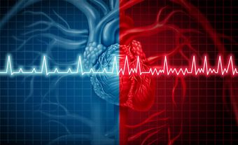 6 Pontos Importantes Sobre Arritmias Cardíacas Que Você Precisa Saber