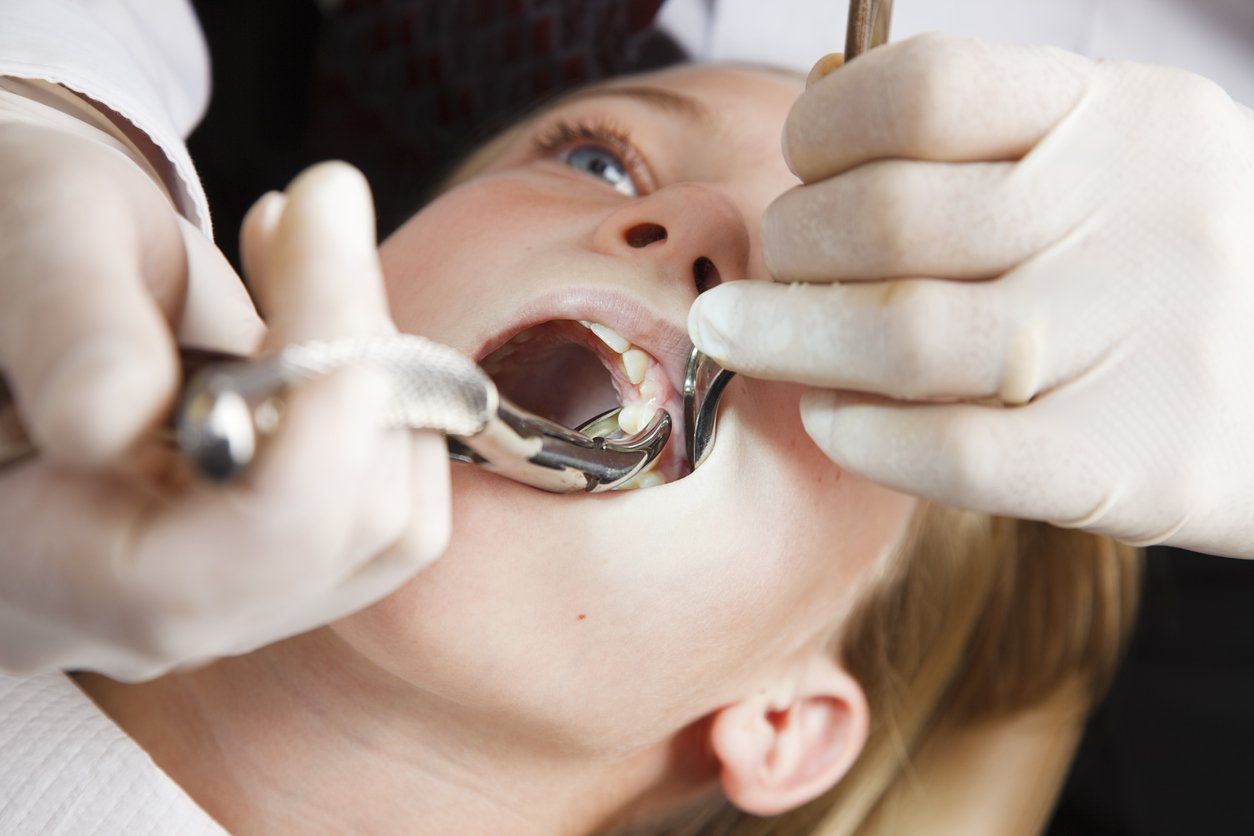 Dental patient being prepped for tooth extraction.