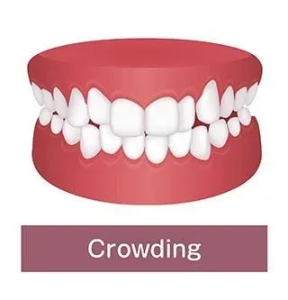 Example of Excessive Crowding Problem