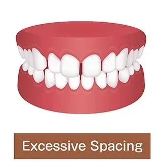 Example of Excessive Spacing Problem