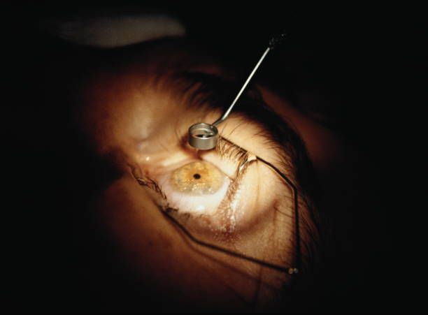 A Close Up Of A Person's Eye With A Needle In It - Cheyenne, WY - Family Vision Center