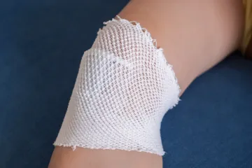Bandaged elbow on a blue surface. White mesh bandage covers the joint.