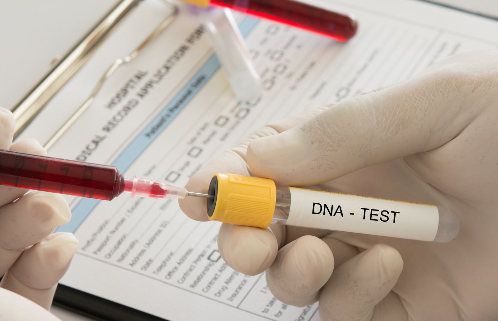 Gloved hands filling a DNA test tube with blood from a syringe, medical form in background.