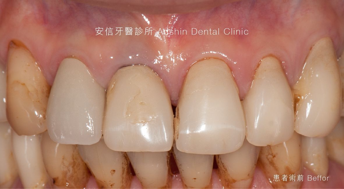 A close up of a person 's teeth with a watermark that says dental clinic