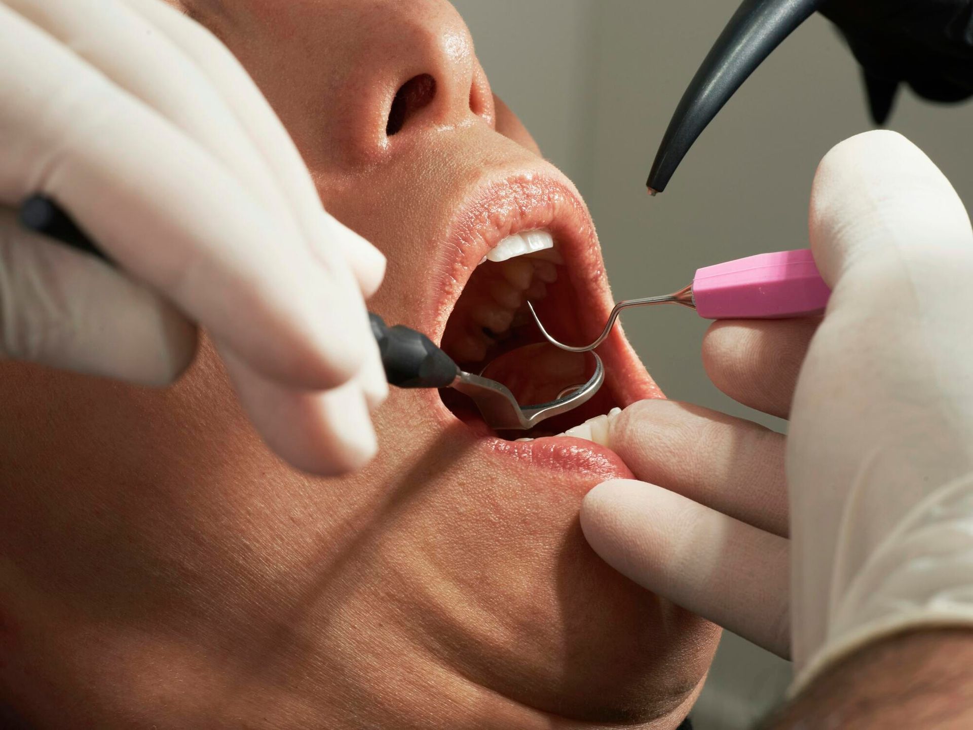 A man is getting his teeth examined by a dentist