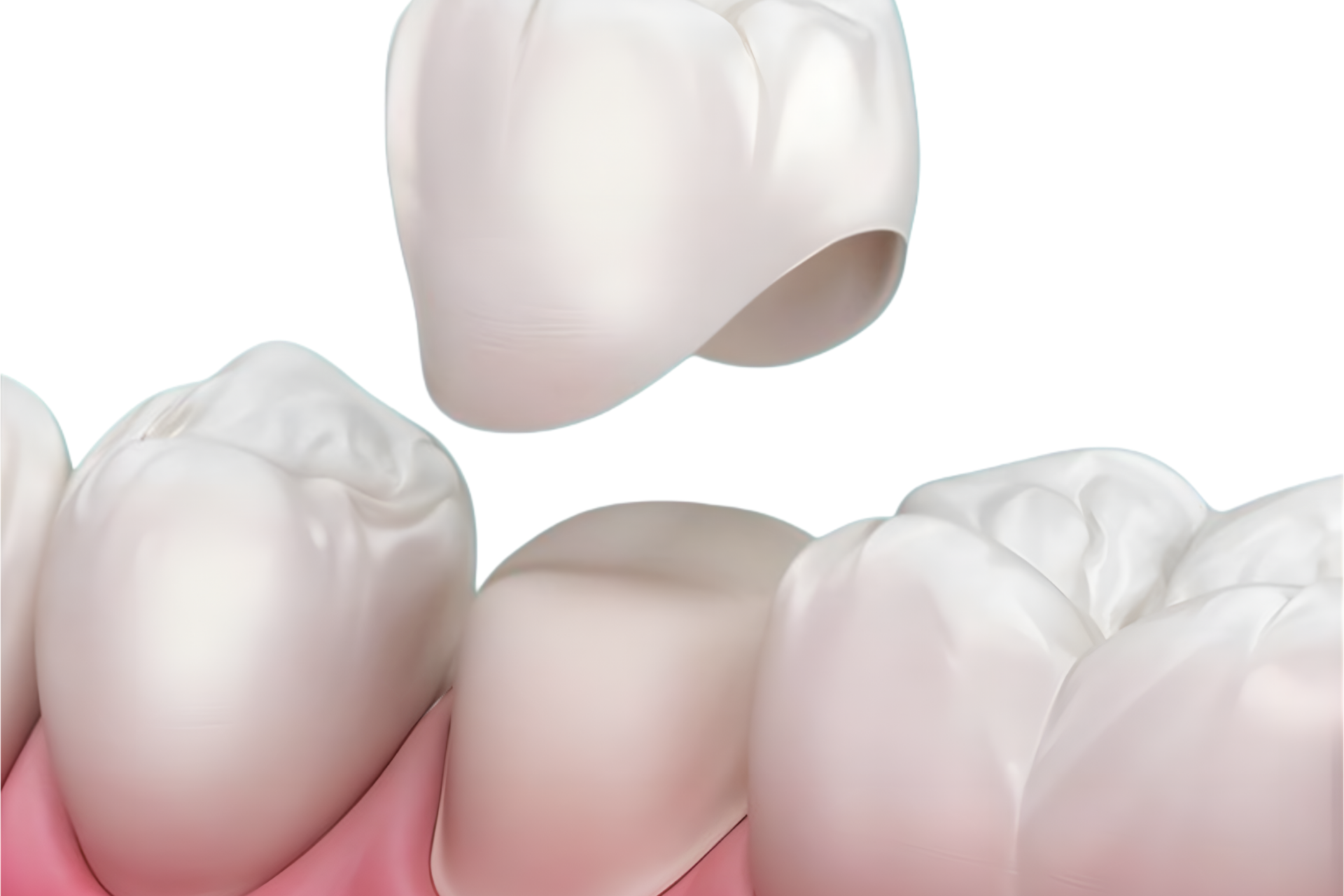 Man in dentist chair, smiling, dental tools near his mouth.
