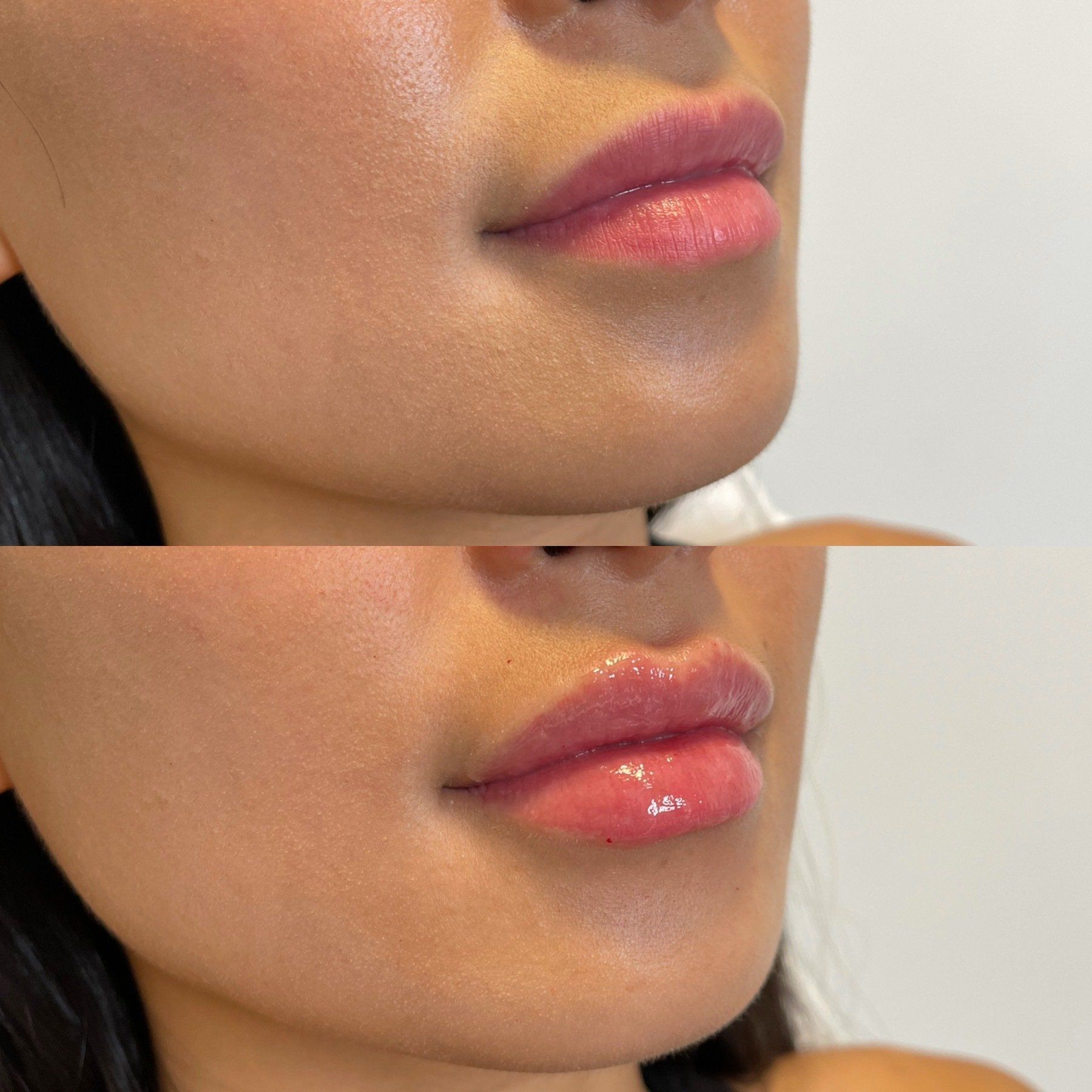 Two close-up views of a person's lips. The bottom one is larger and glossier than the top.