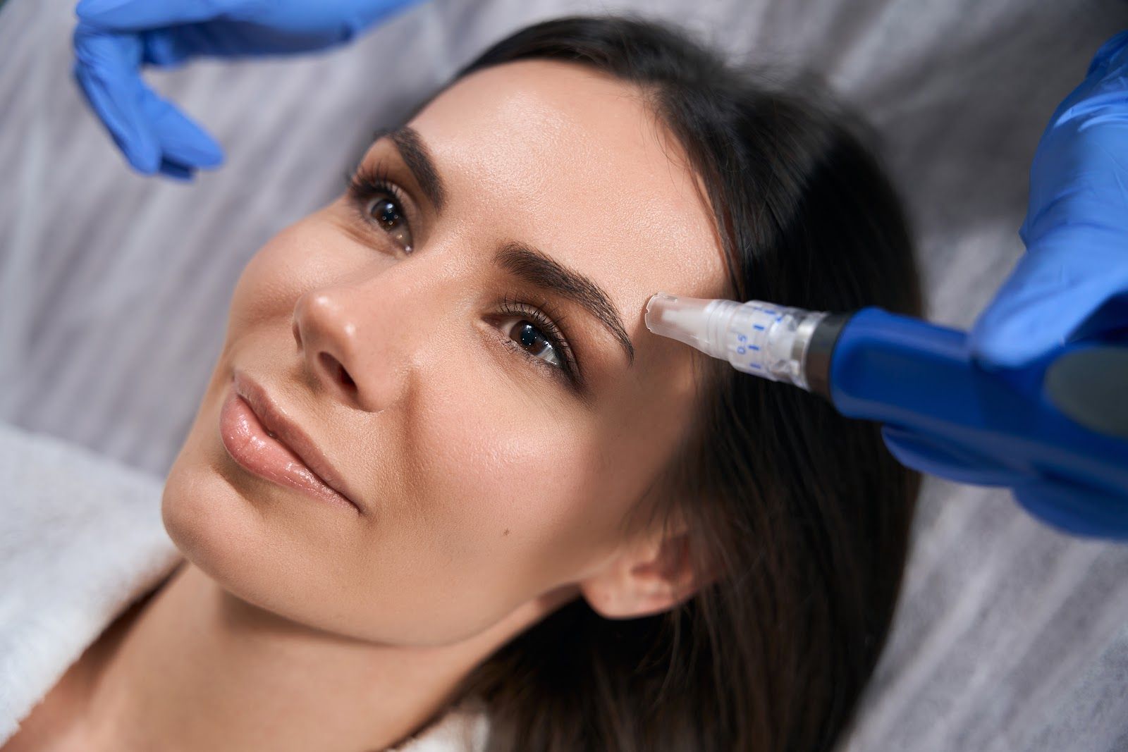 Woman receiving micro-needling treatment on her forehead. Blue gloves and pen-like device are visible.