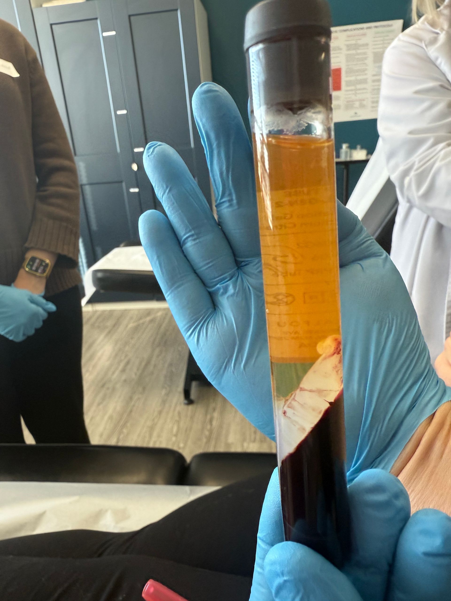 Woman receiving injections in forehead near hairline, gloved hands, syringe visible, blonde hair.