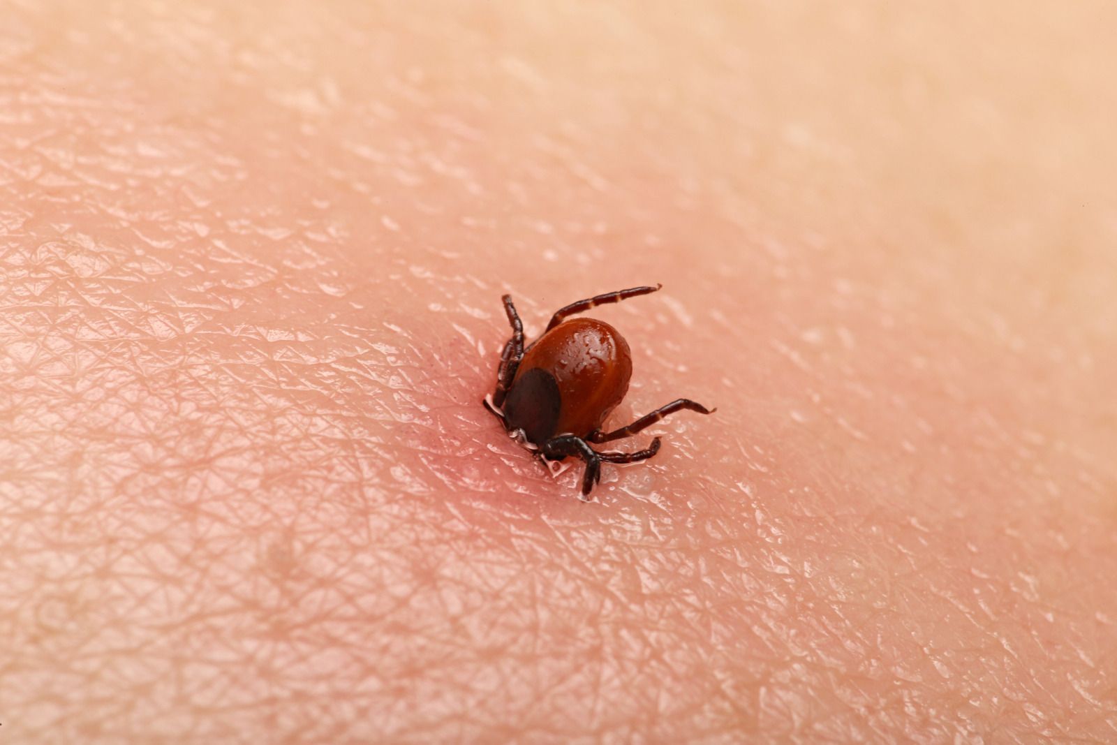 A close up of a tick on a person 's skin.