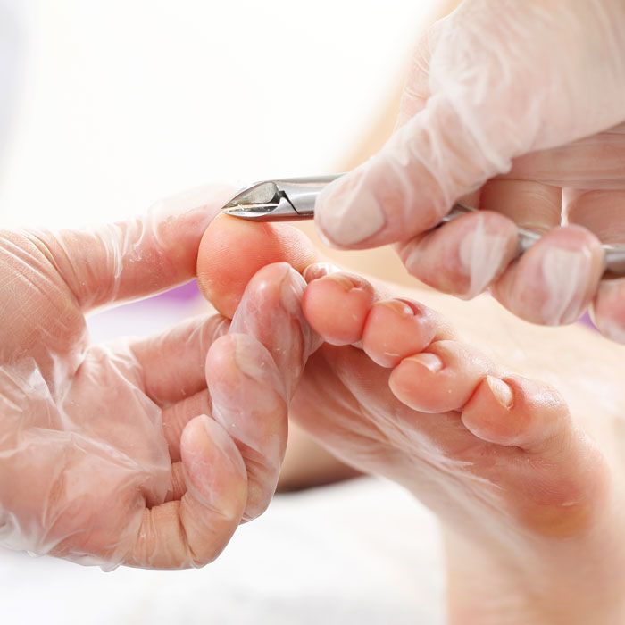 Pedicure Praktijk Hollands Kroon behandeling