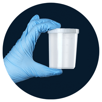 Análisis de orina para examen de vías urinarias
