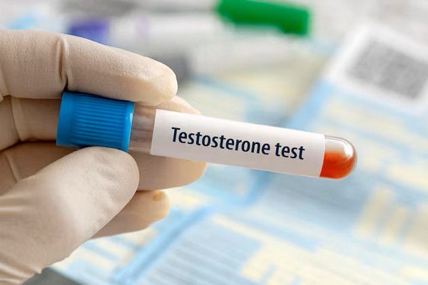 Qué es la testosterona