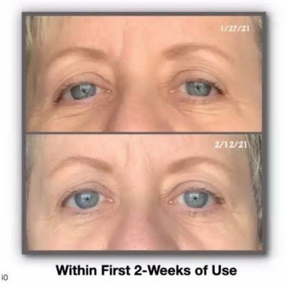 A before and after picture of a woman 's eyes