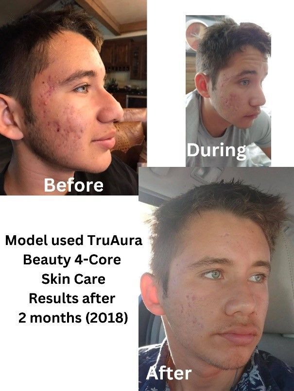 Before & After Skin Care Products