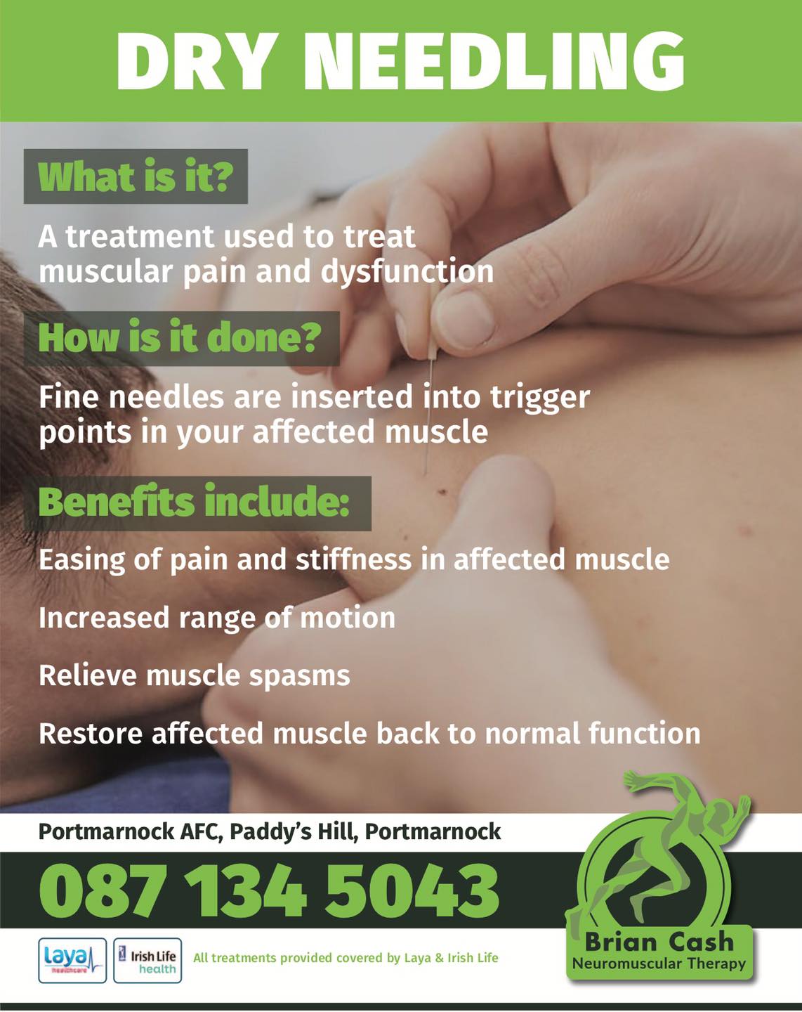 Dry Needling Information