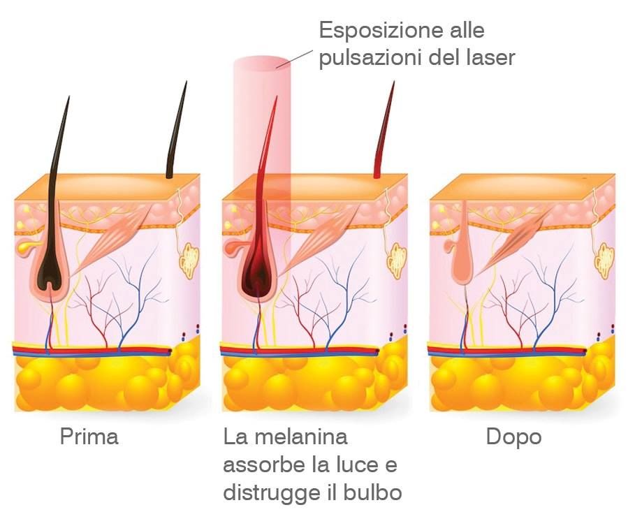 Confronto affiancato del viso di una donna: 