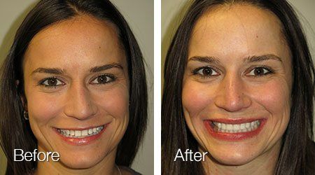 A before and after photo of a woman 's face.