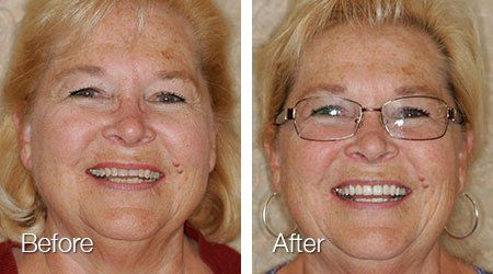 A before and after photo of a woman wearing glasses.