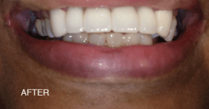 a close up of a person 's mouth