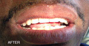 a close up of a man 's mouth