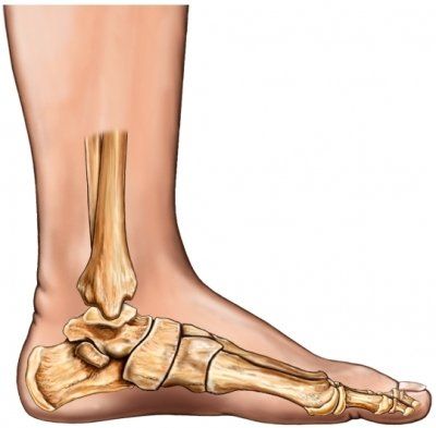 Ankle Fracture Treatment - Moore Foot & Ankle