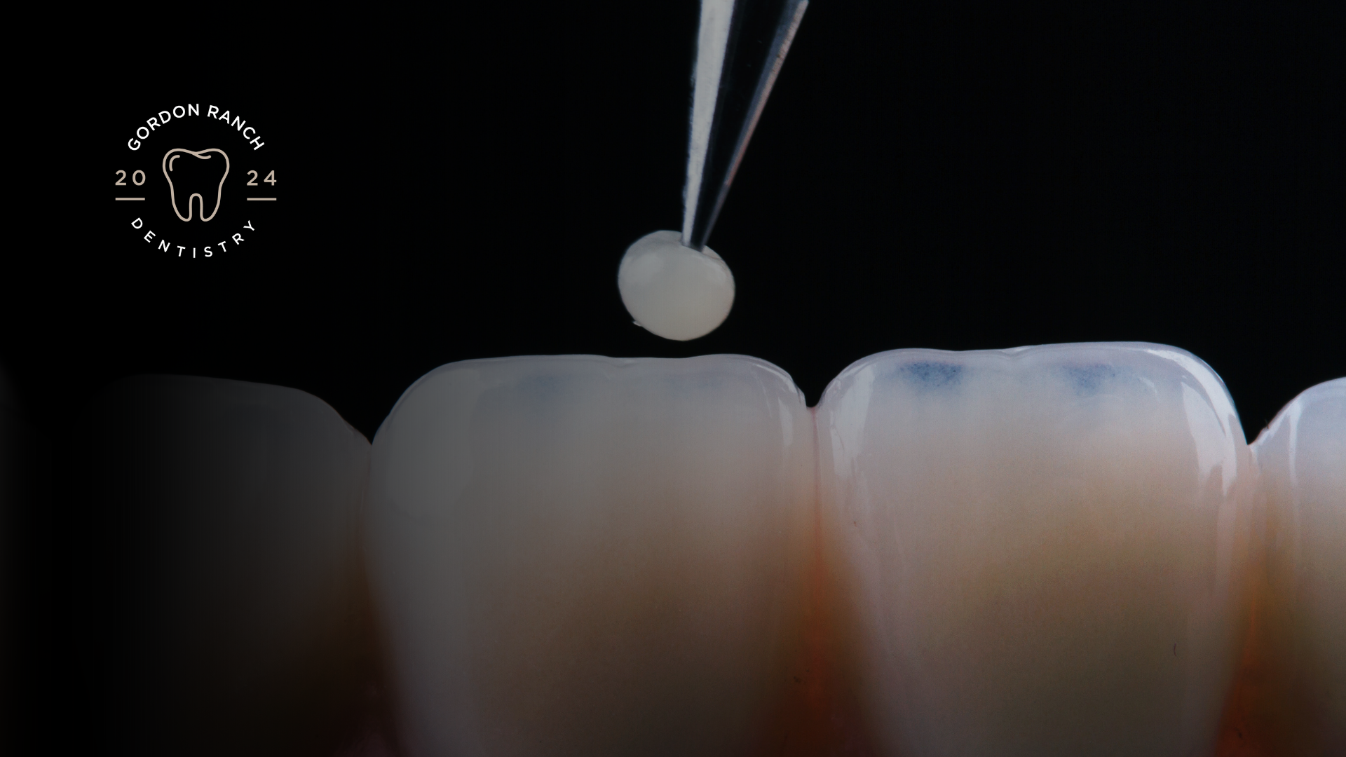 A close up of a tooth with a toothpaste being applied to it.