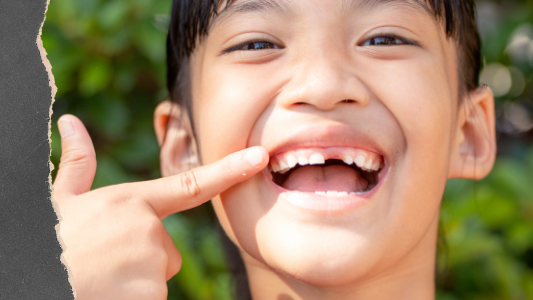 Things You Should Never Do With a Broken Tooth Until You See a Dentist