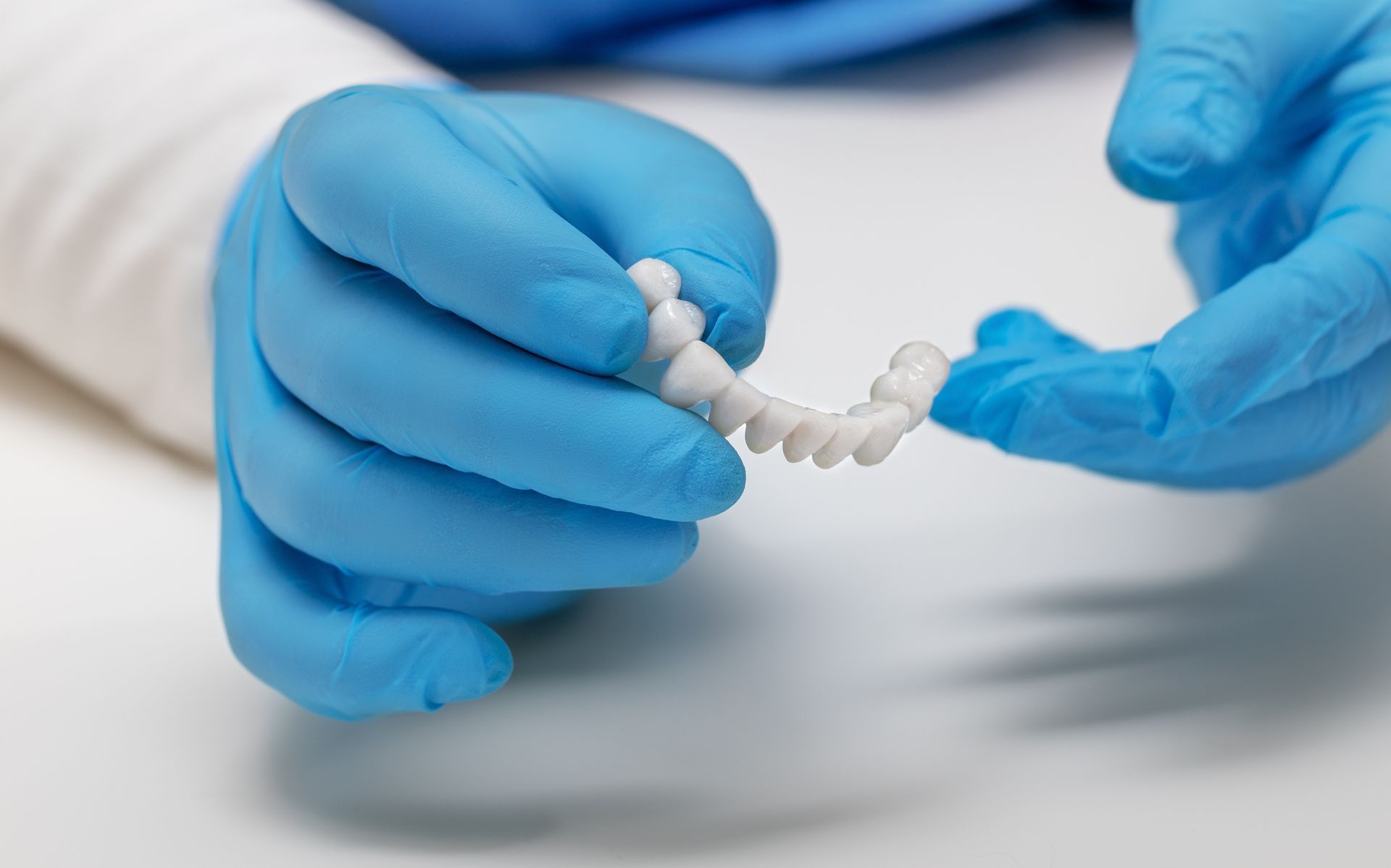 Implant Restoration