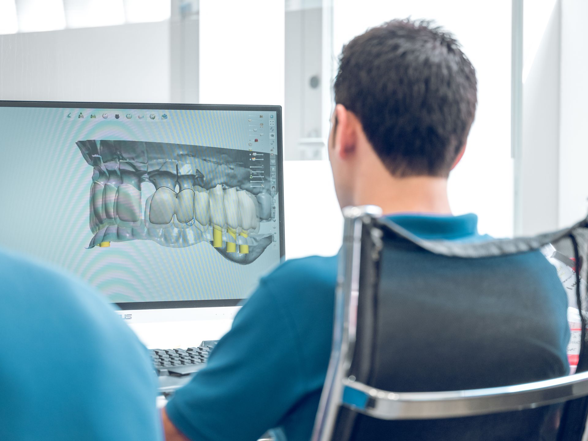 3D dental scan