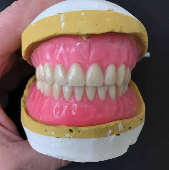 removable prostheses