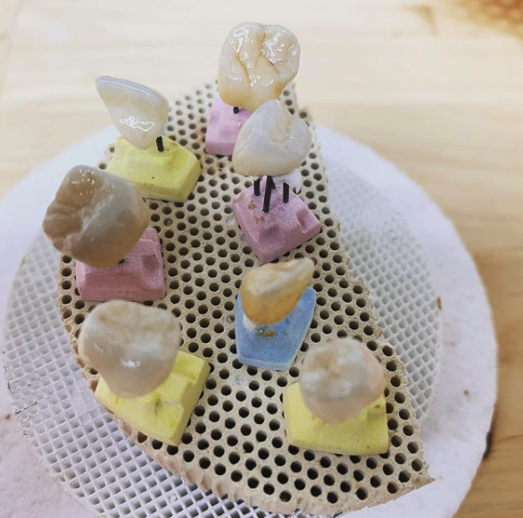 Full Contour Zirconia dental restorations