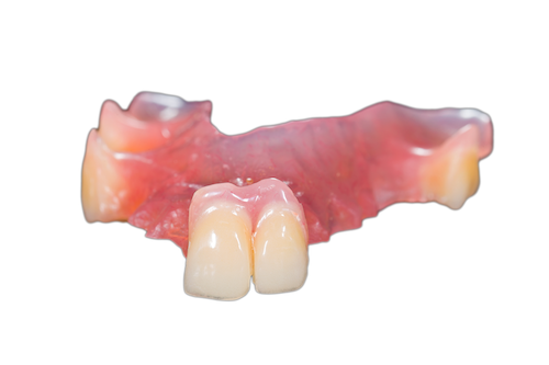 acrylic partial dentures