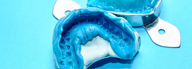 3 Dental Impression Materials and What You Can Expect from Them