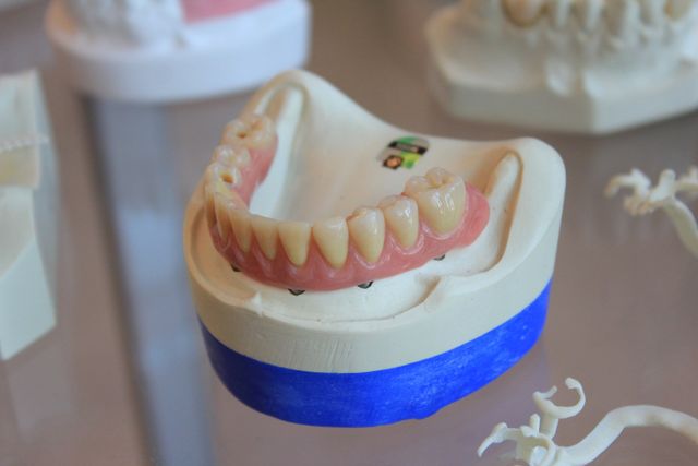 Our Step-By-Step Guide to the Best Partial Denture Technique