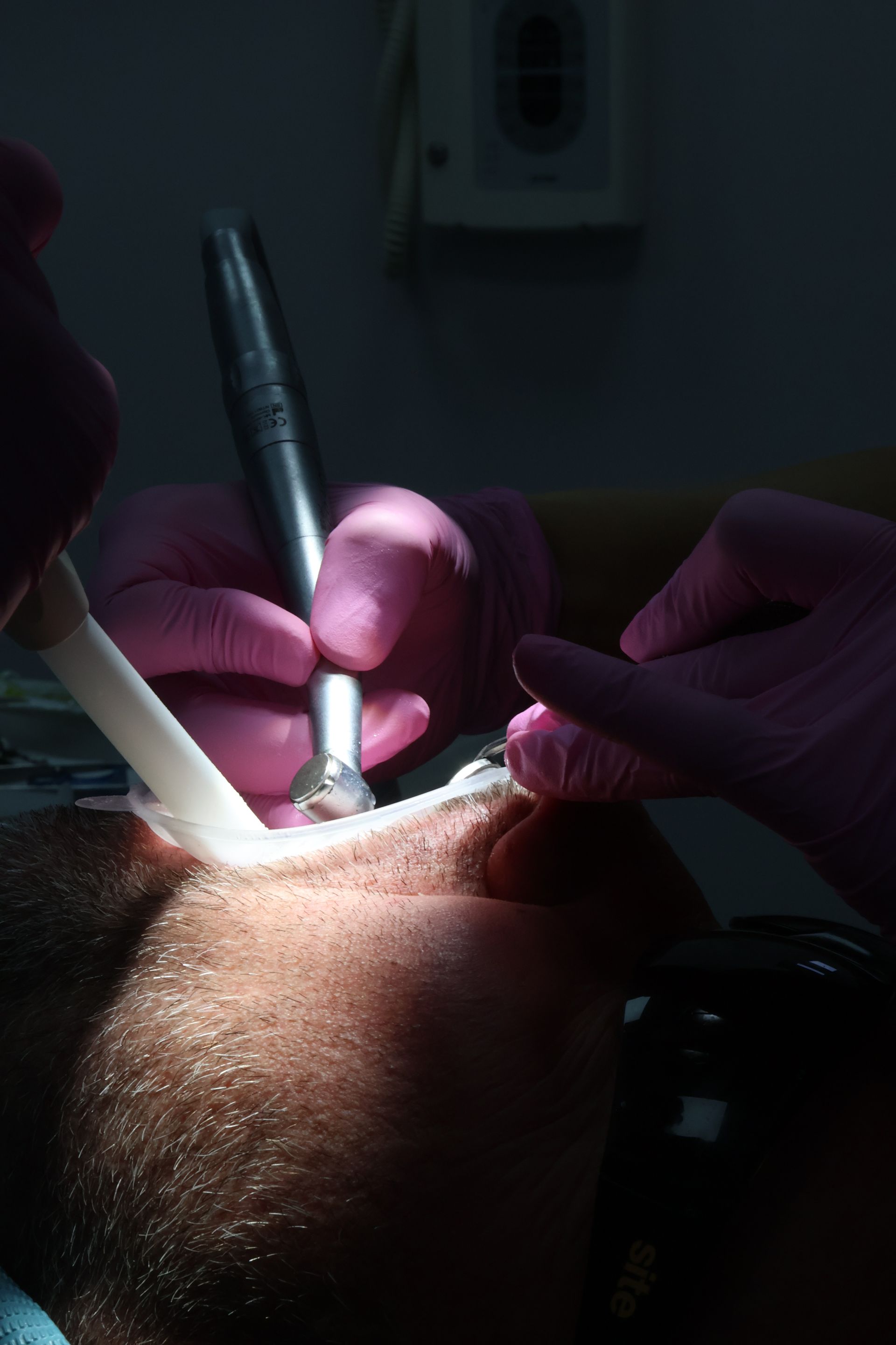 general dentistry in newton-le-willows, newton dental 