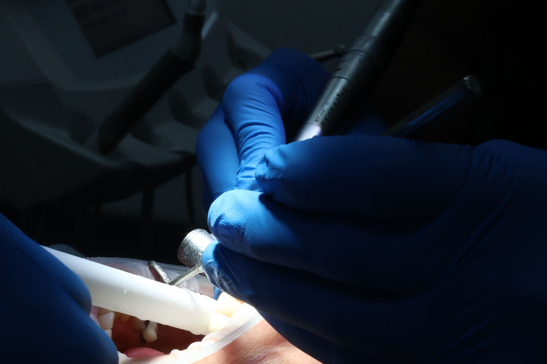 Dentist's gloved hands holding dental tools, working on a patient's open mouth in a dental setting. 
