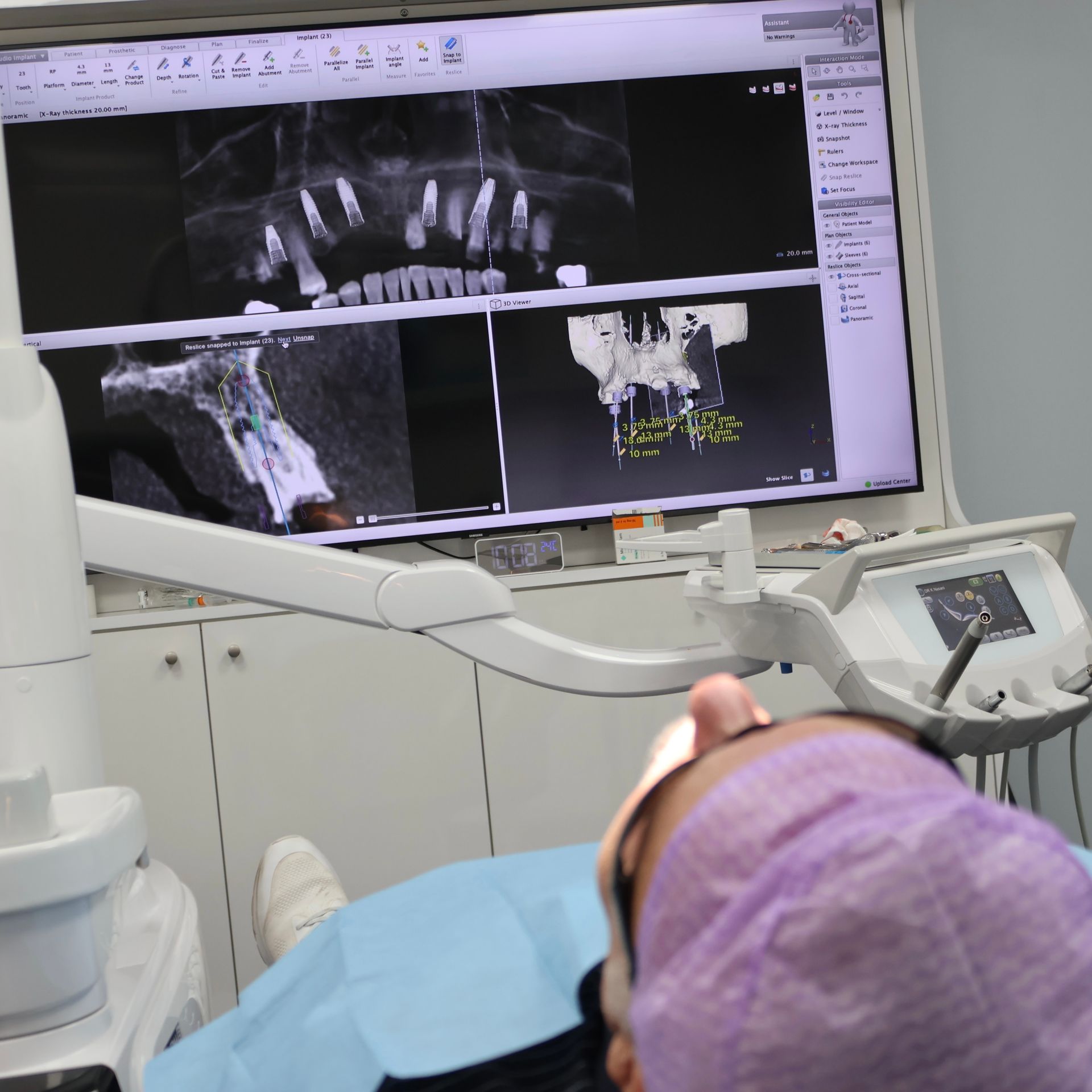 There are many different types of dentures, dental crowns, dental bridges and dental implants. 