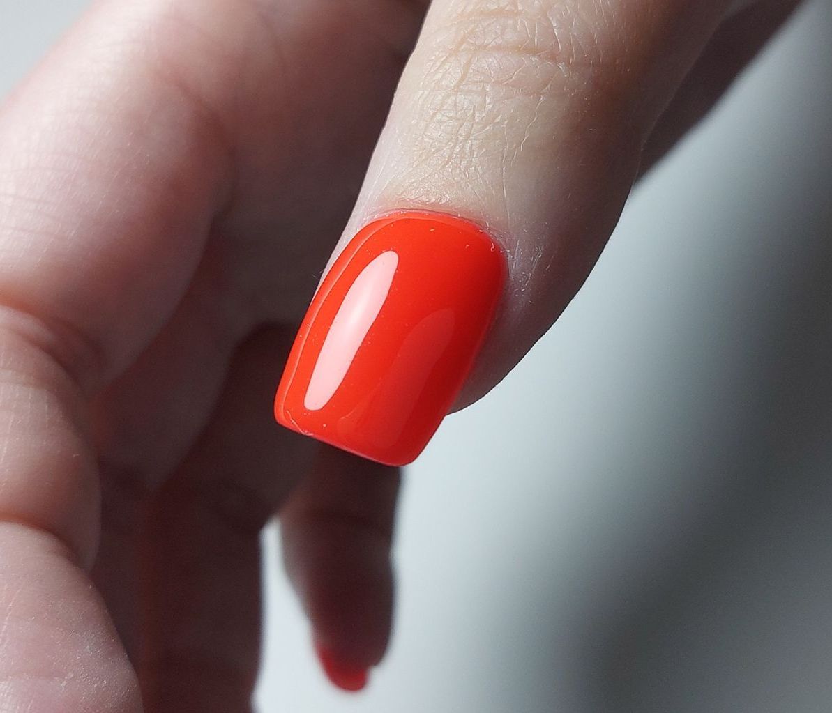 Resultaat van een scheve nagel die gecorrigeerd is – Sint Annaparochie, dichtbij Stiens en Leeuwarden