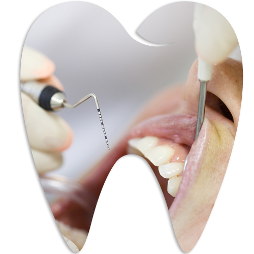 Periodontics — Kingston, NY — Kingston Dental Associates