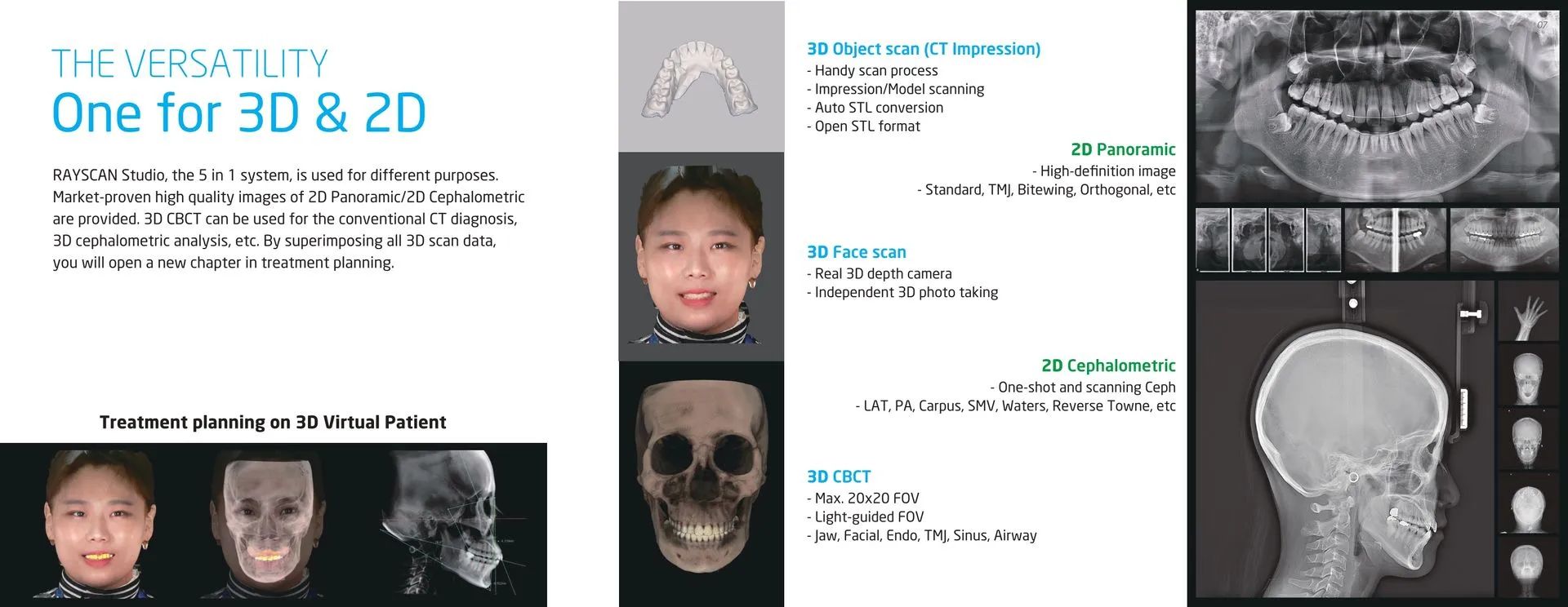 3D And 2D Scan — Kingston, NY — Kingston Dental Associates

