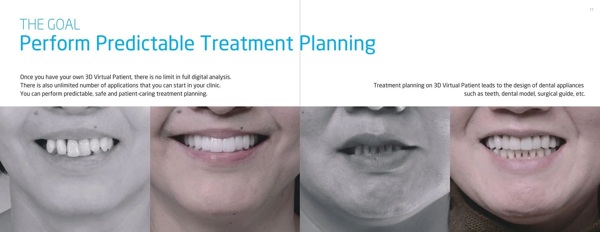 Teeth Treatment — Kingston, NY — Kingston Dental Associates
