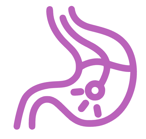 Gastric Reflux Surgery