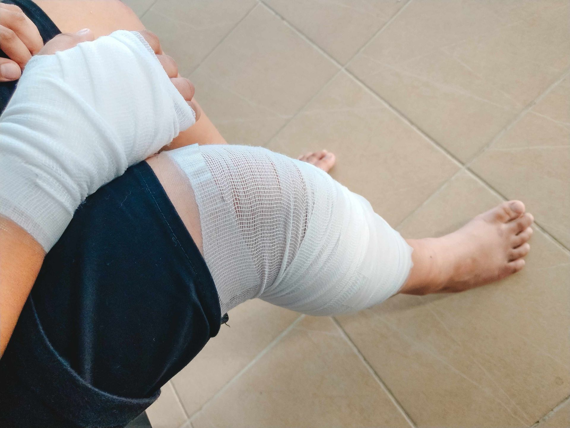 a person with a bandage on their leg