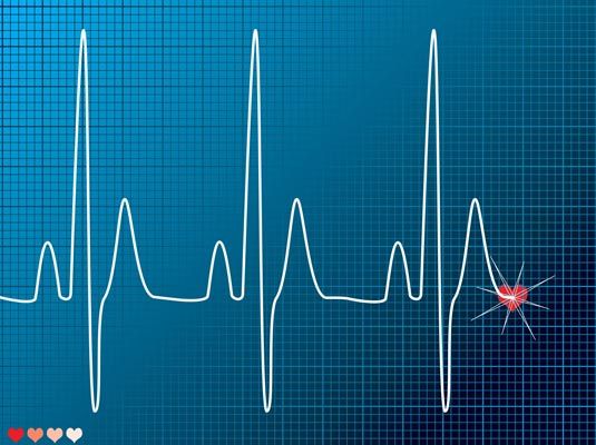 Electrocardiograma, problemas cardiacos, salud del corazón