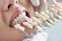 Teeth Checking — Dentistry in Colorado Springs, CO